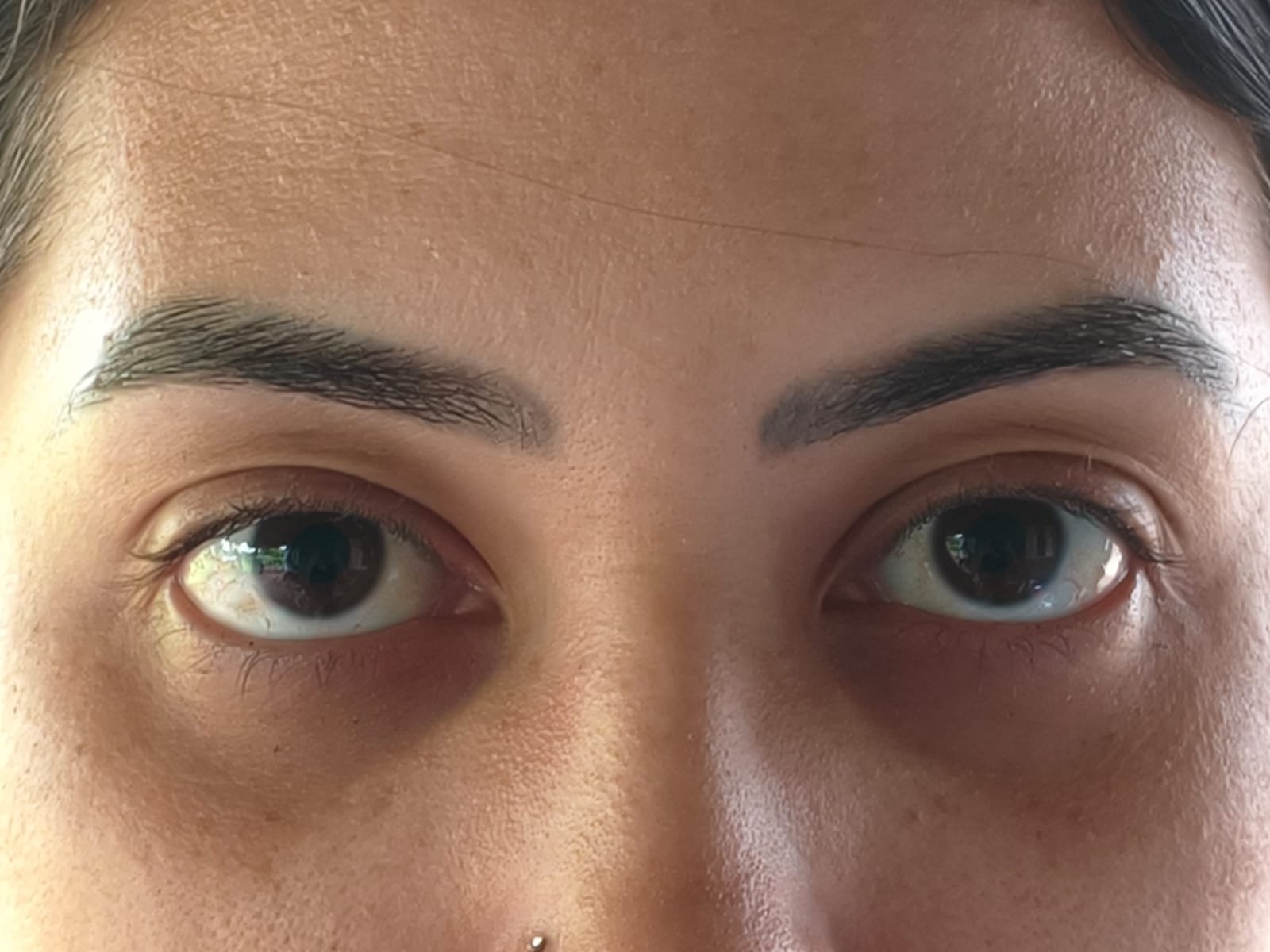 Antes do procedimento - Cliente 1