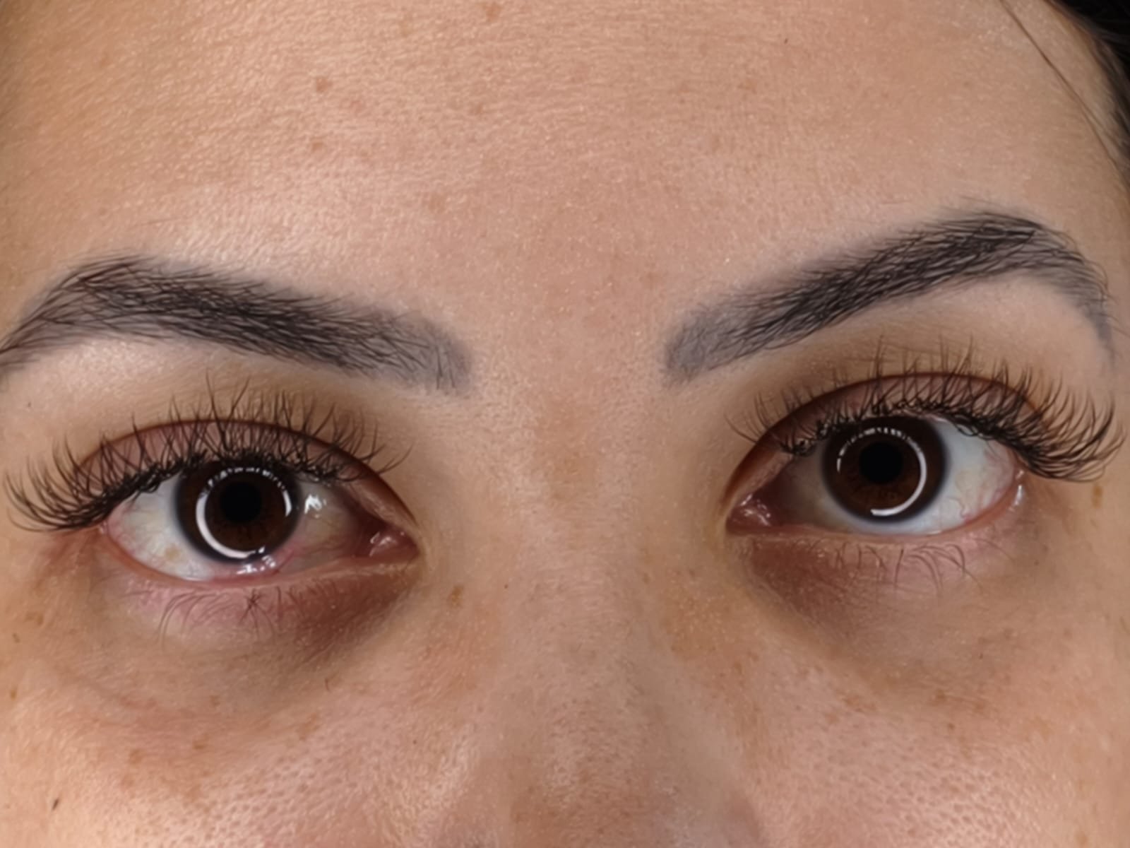 Depois do procedimento - Cliente 1